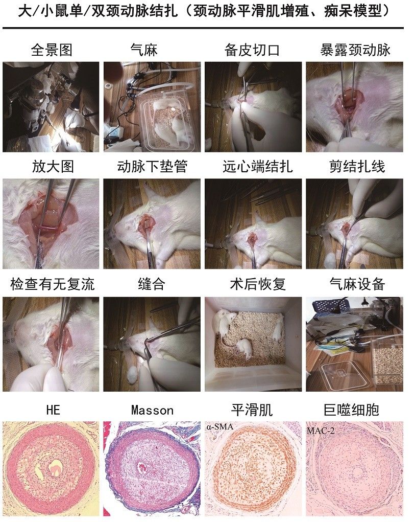 頸動(dòng)脈平滑肌增殖 、癡呆模型 